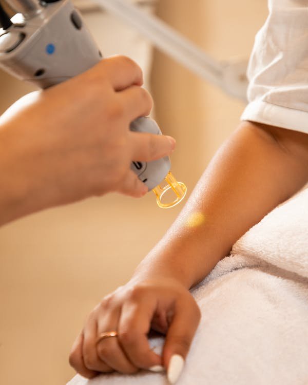 Épilation laser à bordeaux : votre guide des consultations personnalisées
