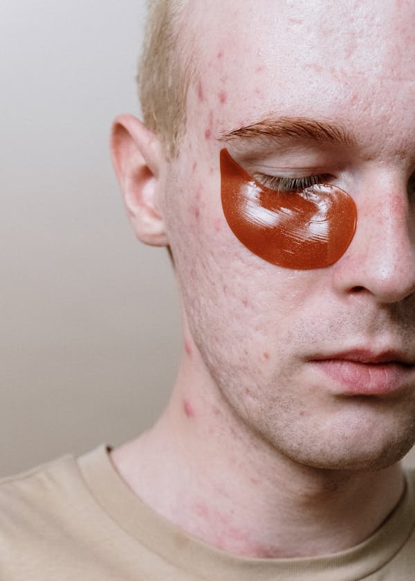 Bouton visage : comprendre les causes et agir rapidement